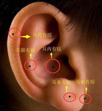 左耳有痣|耳朵长痣的位置图解 耳朵长痣的位置图解有福气